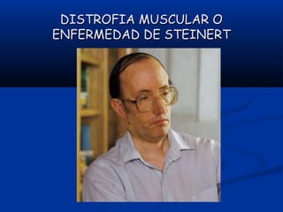 DISTROFIA MUSCULAR ODISTROFIA MUSCULAR O
ENFERMEDAD DE STEINERTENFERMEDAD DE STEINERT
 