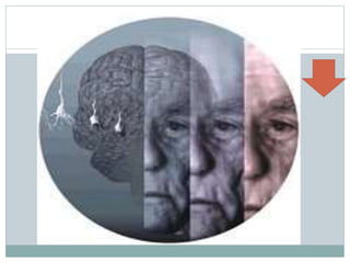 DISTUBIOS AMNESTICO.pptx