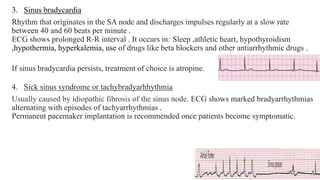 Disturbance of heart rhythm | PPTX