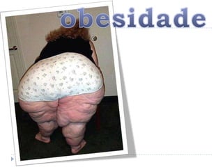 obesidade
