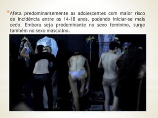 *Afeta predominantemente as adolescentes com maior risco 
de incidência entre os 14-18 anos, podendo iniciar-se mais 
cedo. Embora seja predominante no sexo feminino, surge 
também no sexo masculino. 
 