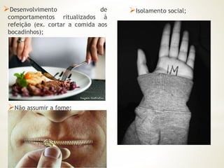 Desenvolvimento de 
comportamentos ritualizados à 
refeição (ex. cortar a comida aos 
bocadinhos); 
Isolamento social; 
Não assumir a fome; 
 