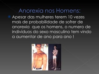 Apesar das mulheres terem 10 vezes mais de probabilidade de sofrer de anorexia  que os homens, o numero de indivíduos do sexo masculino tem vindo a aumentar de ano para ano ! 
