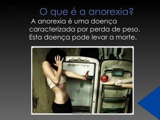 A anorexia é uma doença caracterizada por perda de peso. Esta doença pode levar a morte. 