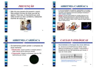 PREVENÇÃO                                        ARRITMIA CARDÍACA
                                                          n É uma anormalidade na freqüência, regularidade ou na origem
n   Não há uma maneira de prevenir o sopro.                 do impulso cardíaco, ou ainda uma alteração na sua condução,
                                                            causando uma seqüência anormal da ativação miocárdica Æ
    Mas existem formas de evitar que ele se                 ritmo cardíaco alterado.
    agrave. Para isso, é importante que você              n Causas: diversas enfermidades do coração (doença do nó
    saiba se tem ou não o problema, realizando              sinusal, bloqueio atrioventricular, hipersensibilidade do seio
                                                            carotídeo, hipertensão arterial, prolapso de válvula cardíaca
    exames de check-up.                                     etc), estresse, cafeína, tabaco, álcool, algumas drogas ilegais e
                                                            alguns medicamentos.




                                                     37                                                                     38
                       www.bioloja.com                                                 www.bioloja.com




      ARRITMIA CARDÍACA                                         CAUSAS PATOLÓGICAS
                                                          n   Anormalidade na formação dos sinais elétricos:
n   Os batimentos podem perder o compasso de
                                                              Ex: Síndrome de Wolf-Parkinson-White: feixes
    duas maneiras:                                            elétricos excedentes no coração Æ taquicardia Æ
    Ø Bradicardia: ocorre quando o coração passa a            freqüências de até 300 batimentos por minuto Æ
      bater menos de 60 vezes por minuto.                     risco de morte súbita.
    Ø Taquicardia: chegam a acontecer mais de 100
      batimentos por minuto.


                                                                  Taquicardia supraventricular Æcomum na
                                                                  síndrome de Wolf-Parkinson-White

                                                     39                                                                     40
                       www.bioloja.com                                                 www.bioloja.com
 