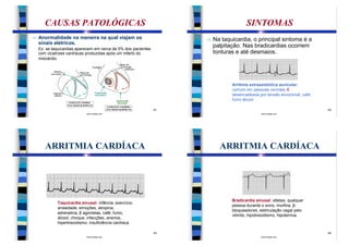 CAUSAS PATOLÓGICAS                                                              SINTOMAS
n   Anormalidade na maneira na qual viajam os                        n   Na taquicardia, o principal sintoma é a
    sinais elétricos.
    Ex: as taquicardias aparecem em cerca de 5% dos pacientes
                                                                         palpitação. Nas bradicardias ocorrem
    com cicatrizes cardíacas produzidas após um infarto do               tonturas e até desmaios.
    miocárdio.




                                                                                Arritmia extrassistólica auricular:
                                                                                comum em pessoas normais Æ
                                                                                desencadeada por tensão emocional, café,
                                                                                fumo álcool.

                                                                41                                                         42
                            www.bioloja.com                                                    www.bioloja.com




       ARRITMIA CARDÍACA                                                   ARRITMIA CARDÍACA




                                                                                Bradicardia sinusal: atletas, qualquer
             Taquicardia sinusal: infância, exercício,
                                                                                pessoa durante o sono, morfina, β-
             ansiedade, emoções, atropina,
                                                                                bloqueadores, estimulação vagal pelo
             adrenalina, β agonistas, café, fumo,
                                                                                vômito, hipotireoidismo, hipotermia.
             álcool, choque, infecções, anemia,
             hipertireoidismo, insuficiência cardíaca

                                                                43                                                         44
                            www.bioloja.com                                                    www.bioloja.com
 