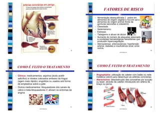 FATORES DE RISCO
                                                          n   Alimentação desequilibrada ] pobre em
                                                              alimentos de origem vegetal e rica em sal e
                                                              alimentos de origem animal (fonte de
                                                              gorduras saturadas e colesterol).
                                                          n   Obesidade.
                                                          n   Sedentarismo.
                                                          n   Estresse.
                                                          n   Tabagismo e abuso de álcool.
                                                          n   Aumento do número de plaquetas associado
                                                              a condições hematológicas hereditárias que
                                                              produzam hipercoagulação.
                                                          n   Aterosclerose, arteriosclerose, hipertensão
                                                              arterial, diabetes e insuficiência renal, entre
                                                              outros.
                                                      9                                                             10
                        www.bioloja.com                                               www.bioloja.com




    COMO É FEITO O TRATAMENTO                                 COMO É FEITO O TRATAMENTO

n   Clínico: medicamentos: aspirina (ácido acetil-        n   Angioplastia: utilização de cateter com balão ou rede
                                                              metálica (stent) para desentupir as artérias coronárias.
    salicílico) e nitratos colocados embaixo da língua
                                                          n   Aterectomia: desobstrução das coronárias por sucção
    (agem mais rápido), engolidos ou usados sob forma         ou laser, através de cateter introduzido em artéria de
    de emplastros sobre a pele.                               braço ou perna.
n   Outros medicamentos: bloqueadores dos canais de
    cálcio e beta-bloqueadores Æ aliviam os sintomas da
    angina.




                                                     11                                                             12
                        www.bioloja.com                                               www.bioloja.com
 