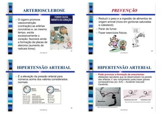 ARTERIOSCLEROSE                                                               PREVENÇÃO

n   O cigarro promove                             n     Reduzir o peso e a ingestão de alimentos de
    vasoconstrição                                      origem animal (ricos em gorduras saturadas
    (contração) as artérias                             e colesterol).
    coronárias e, ao mesmo                        n     Parar de fumar.
    tempo, excita                                 n     Fazer exercícios físicos.
    excessivamente o
    coração; favorece ainda
    a formação de placas de
    ateroma (aumento de
    radicais livres).
                                             21                                                                                                                              22
                     www.bioloja.com                                                                  www.bioloja.com




    HIPERTENSÃO ARTERIAL                              HIPERTENSÃO ARTERIAL
                                                  n    Pode provocar a formação de aneurismas:
n   É a elevação da pressão arterial para              dilatações saculares que se desenvolvem na parede
    números acima dos valores considerados             das artérias Æ seu rompimento pode trazer graves
    normais.                                           conseqüências (ex: AVC –Acidente Vascular
                                                       Cerebral).




                                                                                                               Figura: http://www.utihusf.hpg.ig.com.br/aneurisma_cerebral




                                                      Figura: http://www.neuro.med.br/aneurisma.htm
                                             23                                                                                                                              24
                     www.bioloja.com                                                                  www.bioloja.com
 
