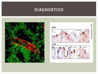 DIAGNOSTICO
 