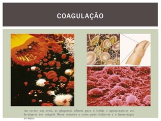 COAGULAÇÃO




Ao cortar um dedo, as plaquetas afluem para a ferida e aglomeram-se até
formarem um coágulo Desta maneira o corte pode fechar-se e a hemorragia
estanca.
 