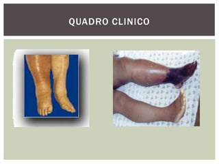 QUADRO CLINICO
 