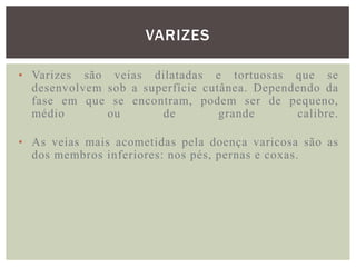 VARIZES

• Varizes são veias dilatadas e tortuosas que se
  desenvolvem sob a superfície cutânea. Dependendo da
  fase em que se encontram, podem ser de pequeno,
  médio       ou       de         grande       calibre.

• As veias mais acometidas pela doença varicosa são as
  dos membros inferiores: nos pés, pernas e coxas.
 