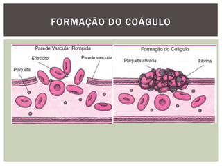 FORMAÇÃO DO COÁGULO
 