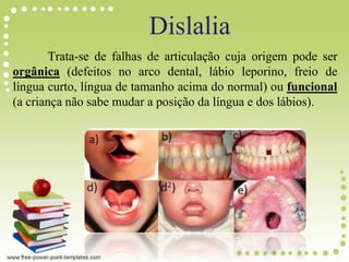 Dislalia
Trata-se de falhas de articulação cuja origem pode ser
orgânica (defeitos no arco dental, lábio leporino, freio de
língua curto, língua de tamanho acima do normal) ou funcional
(a criança não sabe mudar a posição da língua e dos lábios).
 