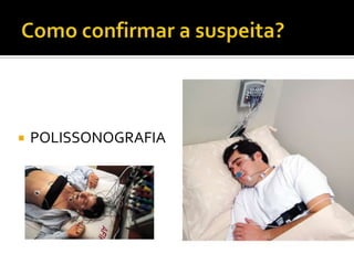  POLISSONOGRAFIA
 