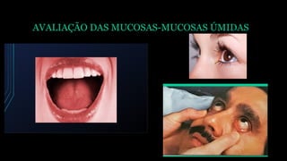 AVALIAÇÃO DAS MUCOSAS-MUCOSAS ÚMIDAS
 