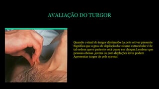 AVALIAÇÃO DO TURGOR
Quando o sinal do turgor diminuído da pele estiver presente
Significa que o grau de depleção do volume extracelular é de
tal ordem que o paciente está quase em choque.Lembrar que
pessoas obesas ,jovens ou com depleções leves podem
Apresentar turgor de pele normal
 