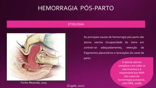 HEMORRAGIA PÓS-PARTO
ETIOLOGIA
As principais causas de hemorragia pós-parto são
atonia uterina (incapacidade do útero em
contrair-se adequadamente), retenção de
fragmentos placentários e lacerações do canal de
parto.
Fonte: Rezende, 2015
(Zugaib, 2012)
A atonia uterina
complica 1 em cada 20
nascimentos e é
responsável por 80%
dos casos de
hemorragia puerperal ,
(JACOBS, 2008)
 