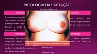 PATOLOGIA DA LACTAÇÃO
INGURGITAMENTO
MAMÁRIO
O ingurgitamento mamário caracteriza-se
pelo aumento de volumes das mamas,
que se apresentam túrgidas, distendidas e
dolorosas a ponto de impedir a
amamentação.
DEFINIÇÃO ETIOLOGIA
Acontece uma retenção por
acotovelamento dos canais galactóforos e
consequente falta de esvaziamento das
mamas.
TRATAMENTO
Sustentação das mamas com sutiãs
apropriados, retirada do leite por
esvaziamento manual ou com bomba de
sucção, a ministração de ocitócitos e a
aplicação de bolsa de gelo.
DIAGNÓSTICO
O diagnóstico é clínico, devendo-se
observar a aparência das mamas e
queixas de dor.
(Zugaib, 2012)
(Rezende, 2015)
 