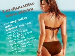 Um dispositivo intra-uterinoUm dispositivo intra-uterino, também conhecido simplesmente como DIU, é um dispositivo anticoncepcional que é inserido no útero, por um médico. 