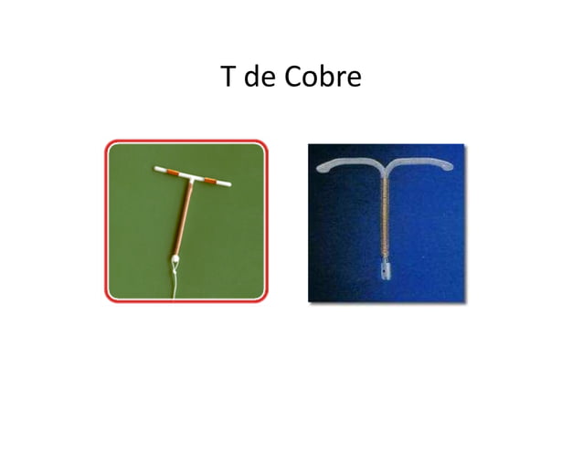 Anticoncepción Intrauterina ( DIU de cobre Vs. DIU hormonal) | PDF