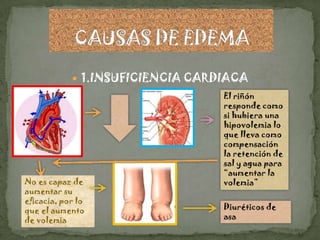  1.INSUFICIENCIA CARDIACA
                                  El riñón
                                  responde como
                                  si hubiera una
                                  hipovolemia lo
                                  que lleva como
                                  compensación
                                  la retención de
                                  sal y agua para
                                  “aumentar la
No es capaz de                    volemia”
aumentar su
eficacia, por lo
que el aumento                    Diuréticos de
de volemia                        asa
 