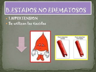  1.HIPERTENSION
 Se utilizan las tiazidas
 