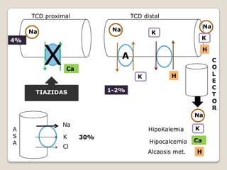 K
Cl
30%
A
Na
A
S
A
TCD proximal TCD distal
C
O
L
E
C
T
O
R
4%
1-2%
Na
Na
Ca
Ca
Na
K
K
K
H
H
H
Na
K
X
TIAZIDAS
HipoKalemia
Hipocalcemia
Alcaosis met.
 