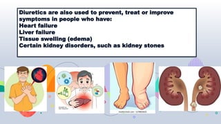 Diuretics are also used to prevent, treat or improve
symptoms in people who have:
Heart failure
Liver failure
Tissue swelling (edema)
Certain kidney disorders, such as kidney stones
 