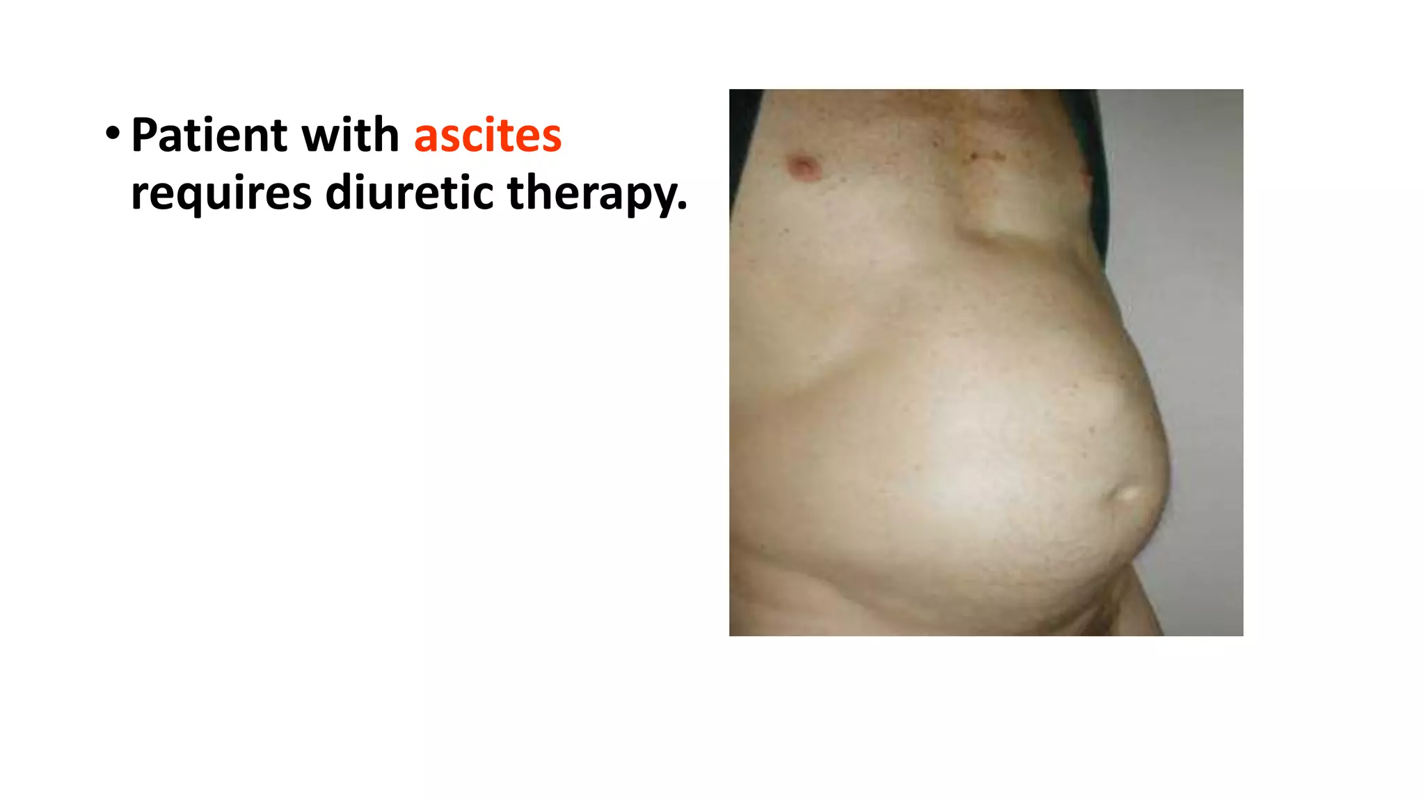 • Patient with ascites
requires diuretic therapy.
 