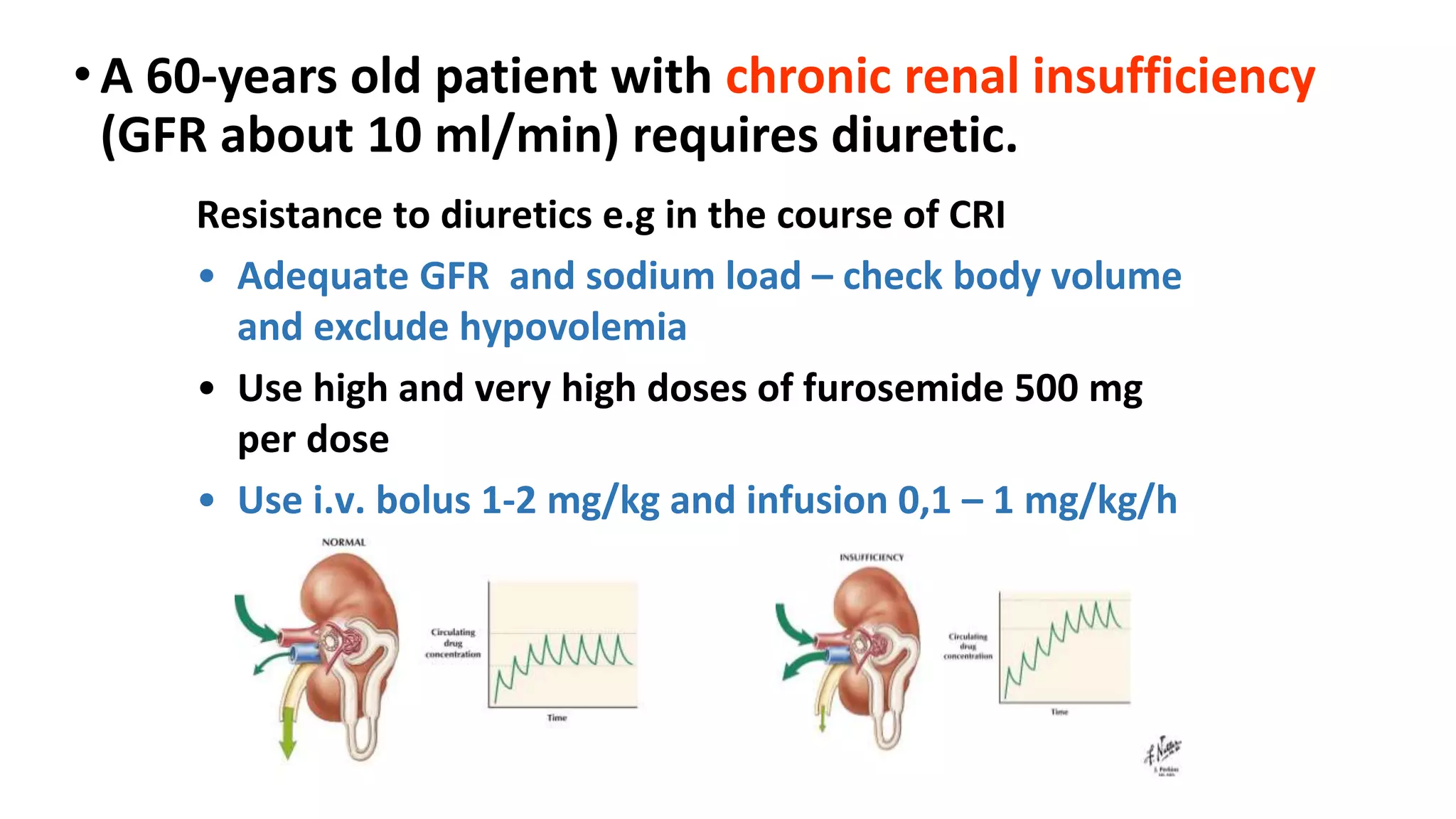 •A 60-years old patient with chronic renal insufficiency
(GFR about 10 ml/min) requires diuretic.
Resistance to diuretics e.g in the course of CRI
• Adequate GFR and sodium load – check body volume
and exclude hypovolemia
• Use high and very high doses of furosemide 500 mg
per dose
• Use i.v. bolus 1-2 mg/kg and infusion 0,1 – 1 mg/kg/h
 
