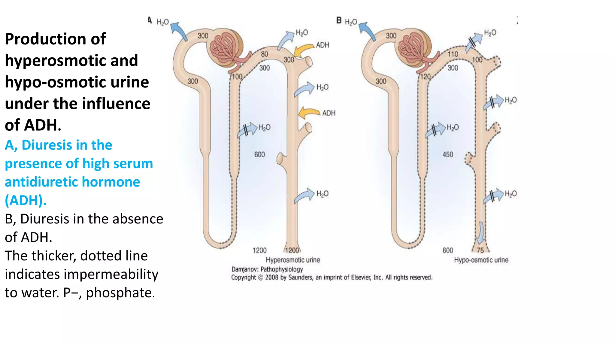 Production of
hyperosmotic and
hypo-osmotic urine
under the influence
of ADH.
A, Diuresis in the
presence of high serum
antidiuretic hormone
(ADH).
B, Diuresis in the absence
of ADH.
The thicker, dotted line
indicates impermeability
to water. P−, phosphate.
 