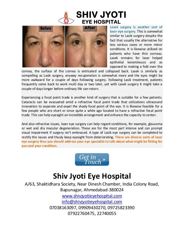 Diverse types of laser eye surgery