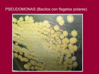 PSEUDOMONAS (Bacilos con flagelos polares) 