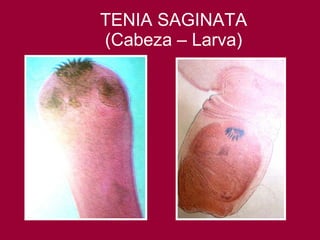 TENIA SAGINATA (Cabeza – Larva) 