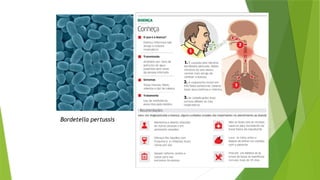 Bordetella pertussis
 