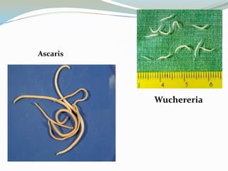 Ascaris

Wuchereria

 