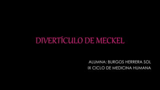 DIVERTÍCULO DE MECKEL
ALUMNA: BURGOS HERRERA SOL
IX CICLO DE MEDICINA HUMANA
 