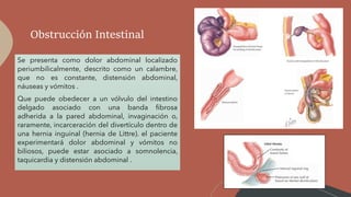 Obstrucción Intestinal
Se presenta como dolor abdominal localizado
periumbilicalmente, descrito como un calambre,
que no es constante, distensión abdominal,
náuseas y vómitos .
Que puede obedecer a un vólvulo del intestino
delgado asociado con una banda fibrosa
adherida a la pared abdominal, invaginación o,
raramente, incarceración del divertículo dentro de
una hernia inguinal (hernia de Littre). el paciente
experimentará dolor abdominal y vómitos no
biliosos, puede estar asociado a somnolencia,
taquicardia y distensión abdominal .
 