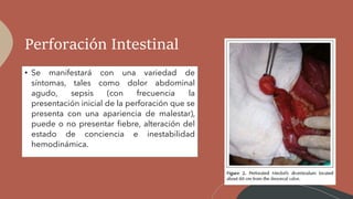Perforación Intestinal
• Se manifestará con una variedad de
síntomas, tales como dolor abdominal
agudo, sepsis (con frecuencia la
presentación inicial de la perforación que se
presenta con una apariencia de malestar),
puede o no presentar fiebre, alteración del
estado de conciencia e inestabilidad
hemodinámica.
 