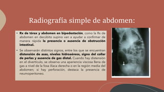 Radiografía simple de abdomen:
• Rx de tórax y abdomen en bipedestación, como la Rx de
abdomen en decúbito supino van a ayudar a confirmar de
manera rápida la presencia o ausencia de obstrucción
intestinal.
• Se observarán distintos signos, entre los que se encuentran
distensión de asas, niveles hidroaéreos, signo del collar
de perlas y ausencia de gas distal. Cuando hay distensión
en el divertículo, se observa una apariencia viscosa llena de
gas a nivel de la fosa ilíaca derecha o en la región media del
abdomen; si hay perforación, destaca la presencia de
neumoperitoneo.
 