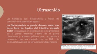 Ultrasonido
 