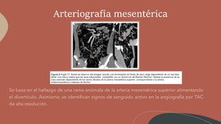 Arteriografía mesentérica
 