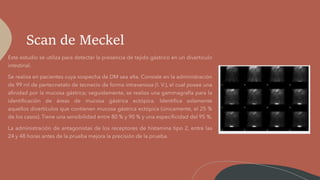 Scan de Meckel
 