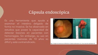 Cápsula endoscópica
 