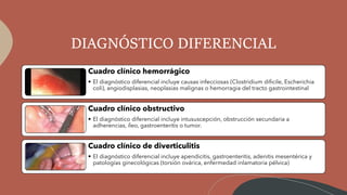DIAGNÓSTICO DIFERENCIAL
Cuadro clínico hemorrágico
• El diagnóstico diferencial incluye causas infecciosas (Clostridium dificile, Escherichia
coli), angiodisplasias, neoplasias malignas o hemorragia del tracto gastrointestinal
Cuadro clínico obstructivo
• El diagnóstico diferencial incluye intususcepción, obstrucción secundaria a
adherencias, íleo, gastroenteritis o tumor.
Cuadro clínico de diverticulitis
• El diagnóstico diferencial incluye apendicitis, gastroenteritis, adenitis mesentérica y
patologías ginecológicas (torsión ovárica, enfermedad inlamatoria pélvica)
 