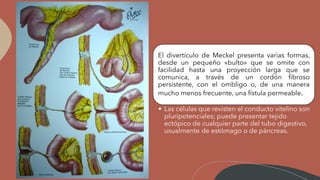 El divertículo de Meckel presenta varias formas,
desde un pequeño «bulto» que se omite con
facilidad hasta una proyección larga que se
comunica, a través de un cordón fibroso
persistente, con el ombligo o, de una manera
mucho menos frecuente, una fístula permeable.
• Las células que revisten el conducto vitelino son
pluripotenciales; puede presentar tejido
ectópico de cualquier parte del tubo digestivo,
usualmente de estómago o de páncreas.
 