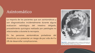 Asintomático
La mayoría de los pacientes que son asintomáticos y
son diagnosticados incidentalmente durante alguna
evaluación radiológica del intestino delgado,
procedimiento quirúrgico realizado por patologías no
relacionadas o durante la necropsia.
En las personas asintomáticas portadoras del
divertículo va a presentar un riesgo de por vida de 4 a
6% de desarrollar complicaciones.
 