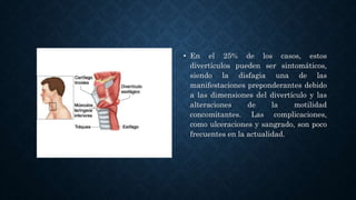 • En el 25% de los casos, estos
divertículos pueden ser sintomáticos,
siendo la disfagia una de las
manifestaciones preponderantes debido
a las dimensiones del divertículo y las
alteraciones de la motilidad
concomitantes. Las complicaciones,
como ulceraciones y sangrado, son poco
frecuentes en la actualidad.
 