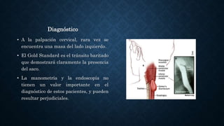 Diagnóstico
• A la palpación cervical, rara vez se
encuentra una masa del lado izquierdo.
• El Gold Standard es el tránsito baritado
que demostrará claramente la presencia
del saco.
• La manometría y la endoscopía no
tienen un valor importante en el
diagnóstico de estos pacientes, y pueden
resultar perjudiciales.
 